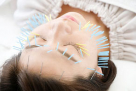 おれんじ接骨院 体質改善ダイエット美顔鍼コース（1か月）のメニュー画像