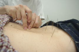 愼命堂鍼灸院 鍼灸（腰痛・首肩こり・スポーツ疾患など）のメニュー画像