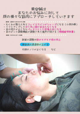 鍼灸院のたけなか 美容鍼（パルスなし）：初回の方のメニュー画像