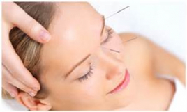鍼灸治療室　Ｍａｕｌｉ 美容鍼コースのメニュー画像
