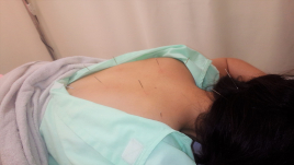鍼灸サロンSachi [初回限定]お身体の鍼・トライアルのメニュー画像