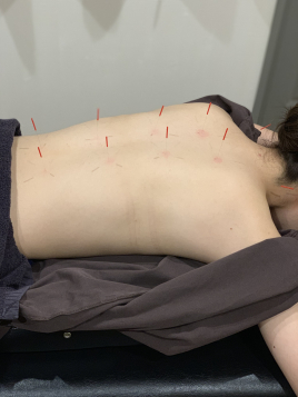 ichigayaの鍼灸整骨院 『全身調整』スタンダードコースのメニュー画像