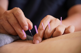 平井鍼灸整骨院 鍼灸治療(スタンダード/2部位)のメニュー画像