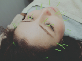 平井鍼灸整骨院 美容鍼灸 1回のメニュー画像