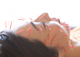 もり鍼灸整骨院今出川マッサージ治療院 美容鍼ベーシックのメニュー画像