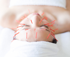 もり鍼灸整骨院今出川マッサージ治療院 美容鍼プレミアムのメニュー画像