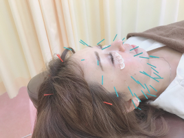 和（あい）はり・きゅう治療院 美容鍼灸　顔の鍼+ヘッドマッサージのメニュー画像