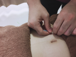 福岡不妊体質改善センター 【はじめての方限定】レディース鍼灸治療のメニュー画像