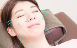 ～さくら整骨院～さくら鍼灸院 さくら式美容鍼灸+フェイシャルフルコースのメニュー画像