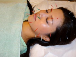 ＮＯＢＵ鍼灸治療院 美容鍼灸総合のメニュー画像