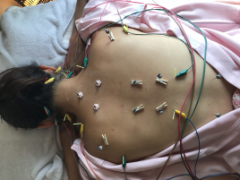 はりきゅう にしはら 東京白金 部分＆美容鍼灸のメニュー画像