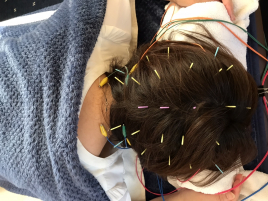 はりきゅう にしはら 東京白金 美髪スペシャルのメニュー画像