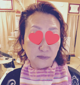 鍼灸指圧ねこまち治療院 ⚫︎刺さない美容鍼＆美顔かっさ＜初回＞のメニュー画像