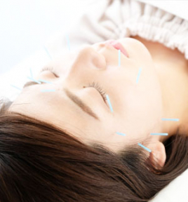 美容鍼灸院-micocoro- 【オススメ】美容鍼コースのメニュー画像