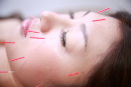 Re:Fine月島店 美容鍼　ショートのメニュー画像