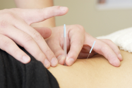 Re:Fine月島店 鍼灸治療　６０分のメニュー画像