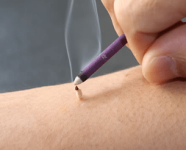 はりきゅう　すずき お灸のみの施術(セルフケア込)のメニュー画像