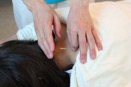 すみ治療院 はり治療のメニュー画像