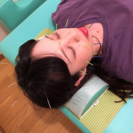 栗木台鍼灸接骨院 美顔鍼のメニュー画像