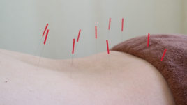 やよい堂整骨院 疲労回復鍼灸のメニュー画像