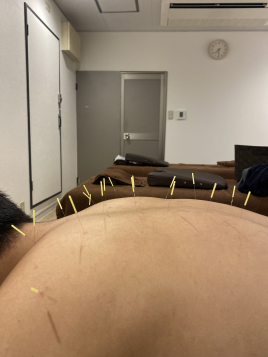 京都西大路　くすのき鍼灸整体院 鍼灸施術（局所）のメニュー画像