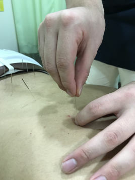天王町そよかぜ鍼灸整骨院 鍼灸治療(保険)のメニュー画像