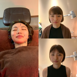 ふくろう針灸院 健康美容鍼コース（身体ほぐし付）初回のメニュー画像