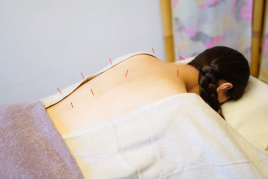 さい美容鍼灸マッサージサロン 鍼灸治療のメニュー画像