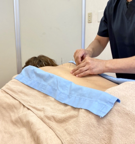鍼灸マッサージ　ＢｏｄｙｃｕｒｅＡｏｉ 総合治療ロングのメニュー画像