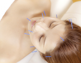 チキバンはり・きゅうサロン 美容鍼スタンダード【初回　4,000円】のメニュー画像