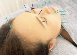 神戸三宮はりきゅう整骨サロンharica 美容顔コースのメニュー画像