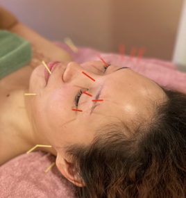 桜木鍼灸治療院 ハリウッド式美容鍼灸のメニュー画像