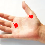 鍼灸整骨院tecu（テク） きゅう治療のメニュー画像