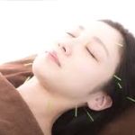 鍼灸整骨院tecu（テク） 美容鍼（美顔鍼）でお肌を健康に！のメニュー画像