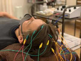 リアン鍼灸治療院 電気を流すヘッドスパのメニュー画像