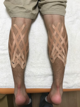 ささき鍼灸院 各種テーピングのメニュー画像