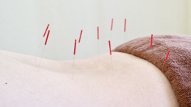 はり灸院Anchor 明石スポーツ鍼灸整体 全身鍼灸〜人気NO.2メニュー〜のメニュー画像