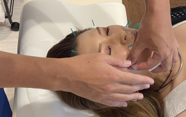 はり灸院Anchor 明石スポーツ鍼灸整体 美容鍼のメニュー画像