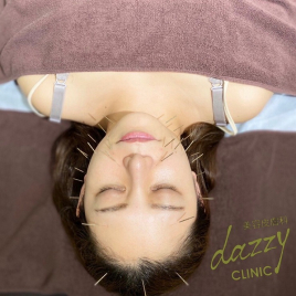 デイジークリニック（dazzy CLINIC） ゴールド美容鍼＋鍼灸のメニュー画像