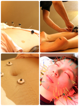 名駅せんが鍼灸院 電気美容鍼 53本＋全身鍼灸治療のメニュー画像