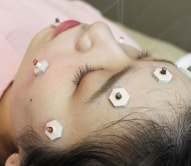 名駅せんが鍼灸院 お灸 一部位 のメニュー画像