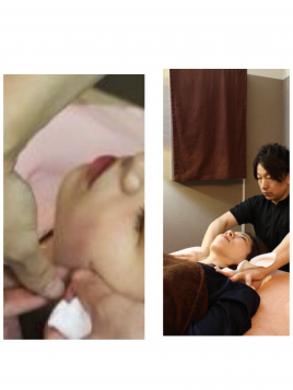 名駅せんが鍼灸院 リンパケア＋美容鍼のメニュー画像