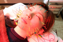 名駅せんが鍼灸院 電気美容鍼 53本のメニュー画像