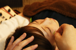 名駅せんが鍼灸院 毛穴引き締め美顔鍼灸のメニュー画像