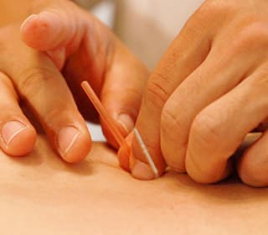 おおいそ鍼灸治療院 マッサージ＋鍼治療のメニュー画像