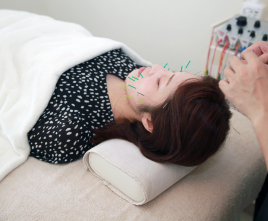 美容鍼灸サロンHARINOS 【美肌再生美容鍼コース】のメニュー画像