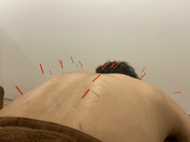 京都西大路　くすのき鍼灸整体院 鍼灸施術（全身）のメニュー画像