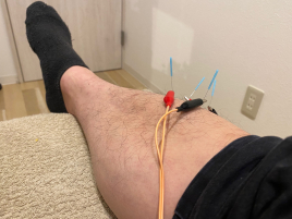 京都西大路　くすのき鍼灸整体院 鍼通電施術（局所）のメニュー画像