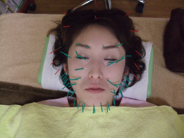 ほり鍼灸院・HORI美容整体院 美顔鍼のメニュー画像