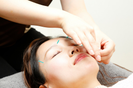 おざき鍼灸整骨院　美容鍼灸サロンOZAKI 美容鍼灸施術のメニュー画像